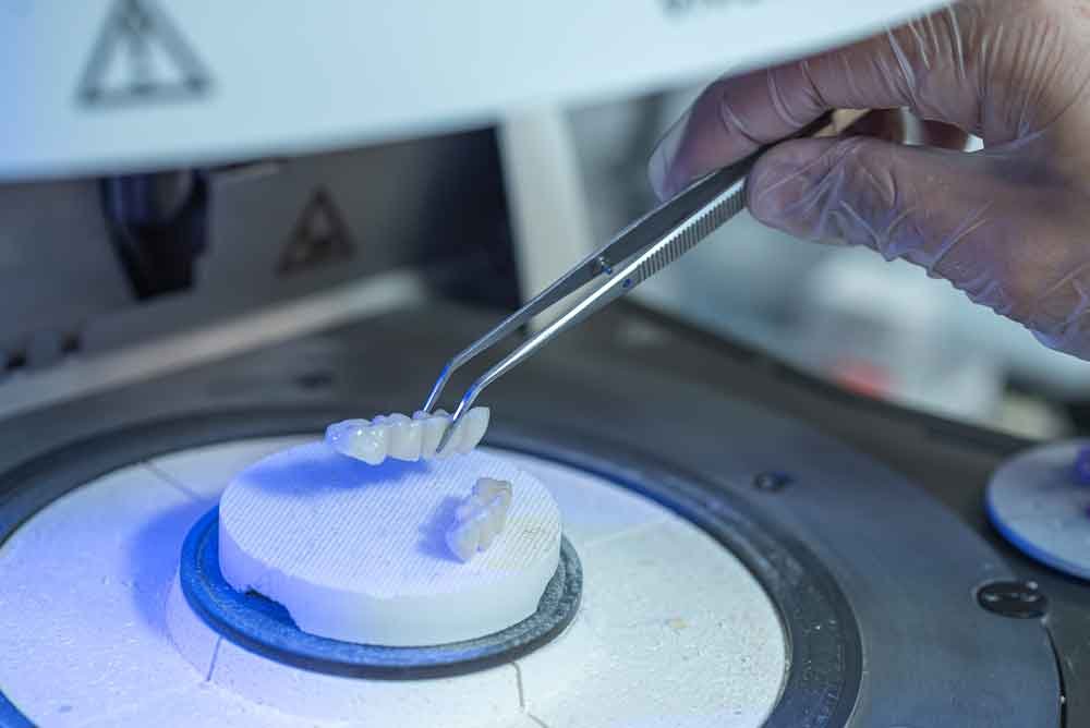 A technician prepares a dental restoration in OG Center’s own laboratory